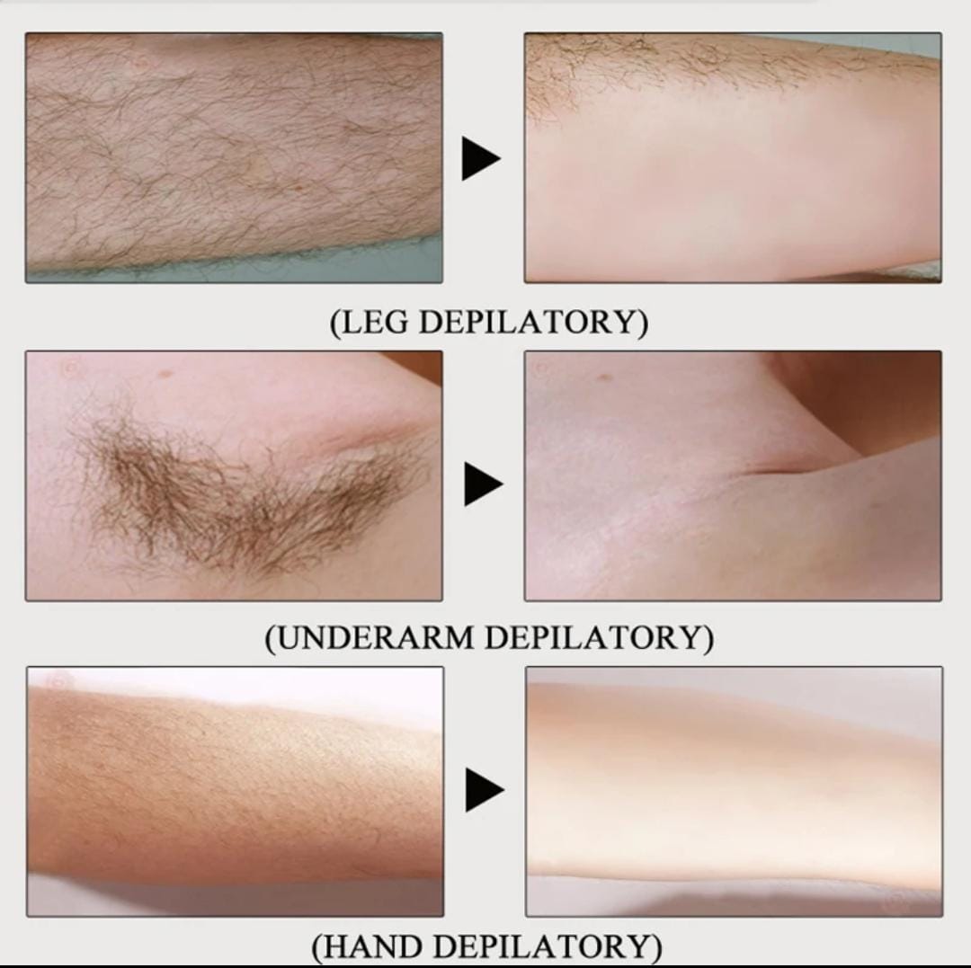 Permanent Hair Removal Cream for Men & Women